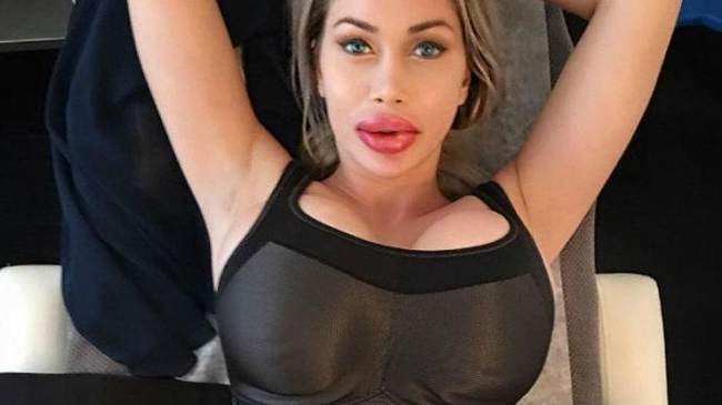 Горшочек, не вари! «Живая кукла» увеличила губы до рекордных размеров