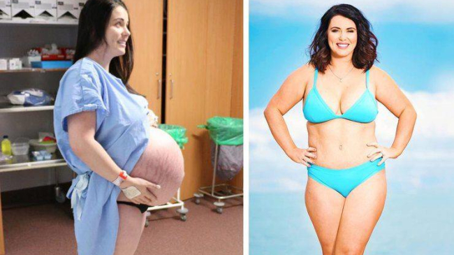 Мама восьмерых детей, в том числе пятерняшек, преобразилась за $18 тысяч