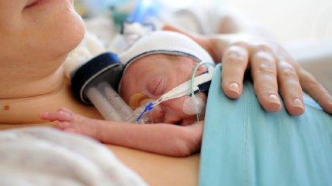 Сегодня отмечается Международный день недоношенных детей