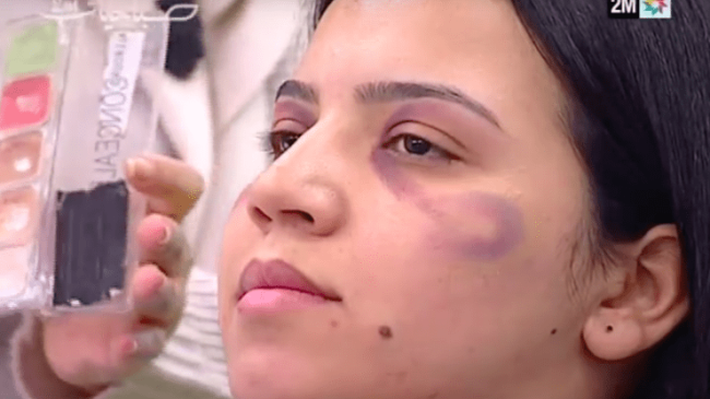 В эфире марокканского шоу дали советы по макияжу для избитых мужьями женщин