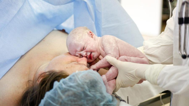 Все больше женщин в Молдове рожают путем кесарева сечения