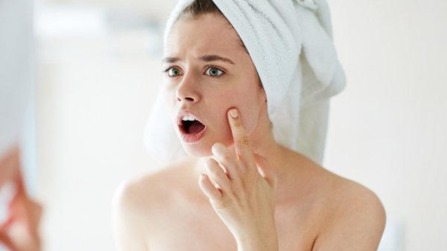 Как делать макияж, если кожа шелушится: 7 правил