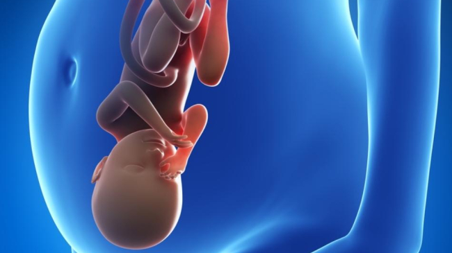 O noua inventie inedita pentru nastere!