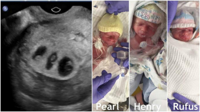 Doctorii i-au spus să aleagă care dintre cei 3 bebeluşi va trăi. Decizia ei a şocat o lume întreagă!