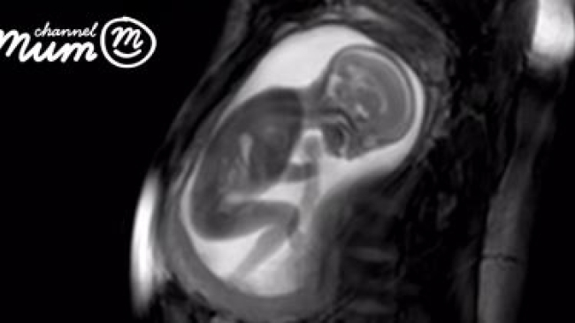 Медики сняли на видео сердцебиение ребёнка в утробе матери