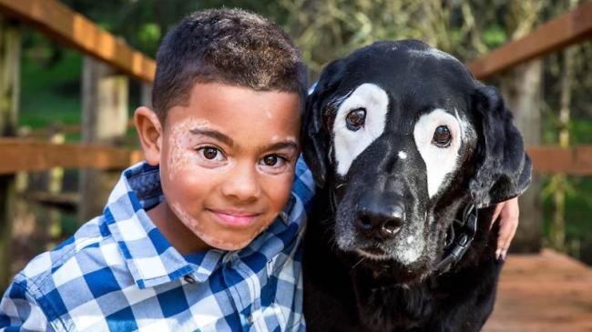 Мальчика и собаку подружила общая болезнь