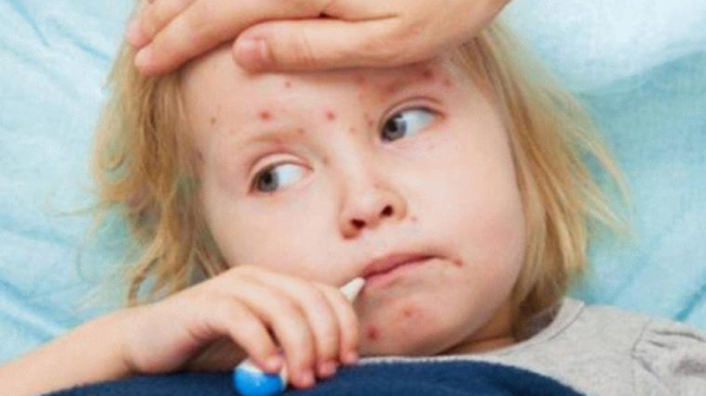 OMS: România e principalul focar de rujeolă din Europa