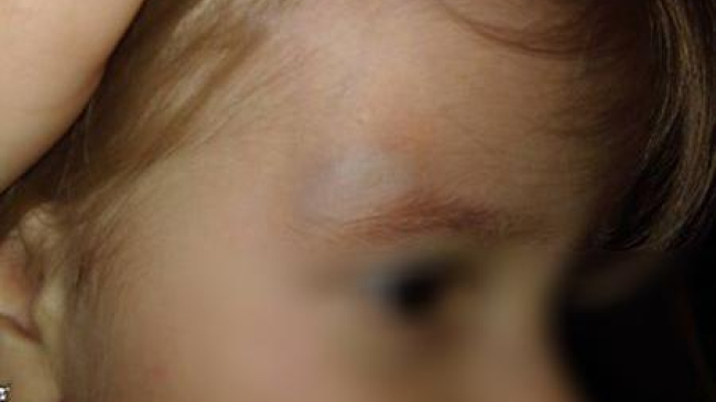 Двухлетняя девочка пострадала в маршрутке из-за безответственности водителя!