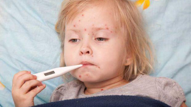 Sute de noi cazuri de rujeolă într-o singură săptămână
