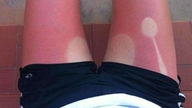 Fotografii amuzante! Top-ul oamenilor boronzați aiurea