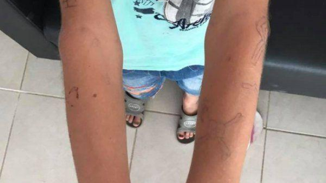 Беспредел в летнем лагере: дети употребляют алкоголь и рисуют на руках свастику