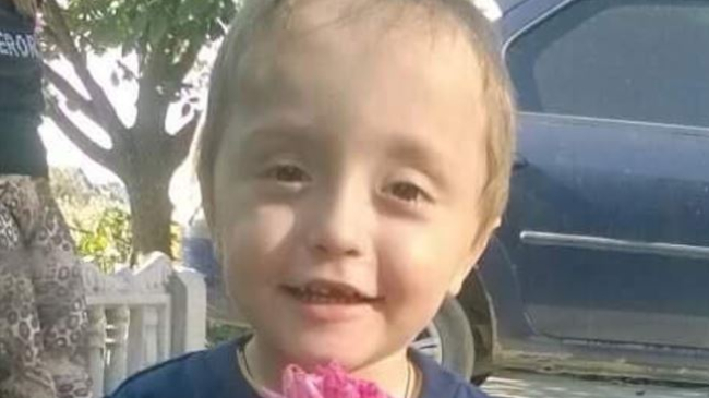 Un băiețel de doar trei ani, diagnosticat cu o afețiune gravă a craniului, are nevoie de ajutor