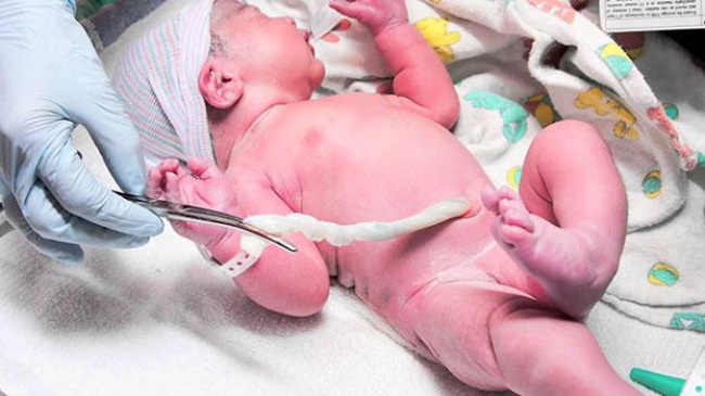 O familie de români a refuzat tăierea cordonului ombilical al nou-născutului. Iată ce a urmat
