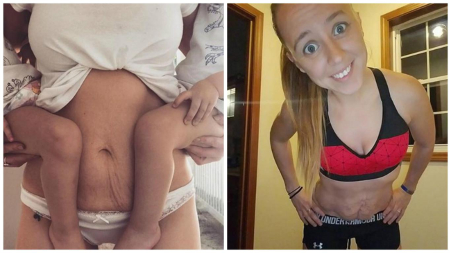 Mămicile nu-și mai ascund pielea lăsată și vergeturile de după naștere