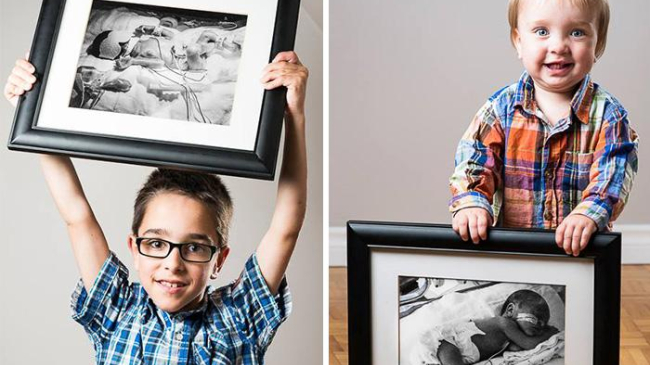 До и после: фотографии детей, которые родились раньше срока