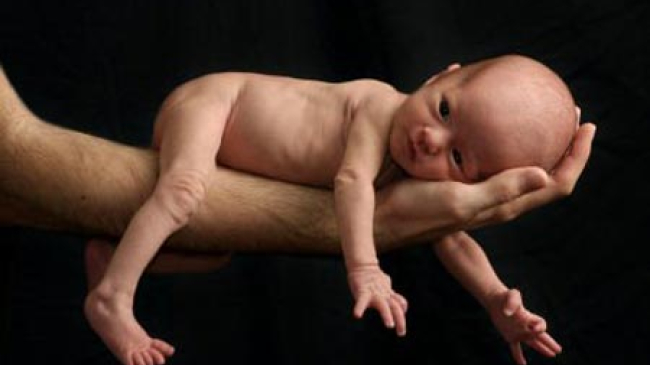 Expoziție de caritate dedicată copiilor născuți prematur