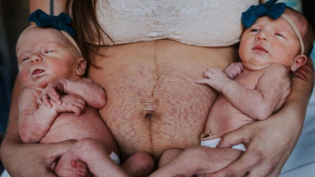 Fiul a întrebat-o ce s-a întâmplat cu burta ei. Iată ce i-a răspuns mama sa