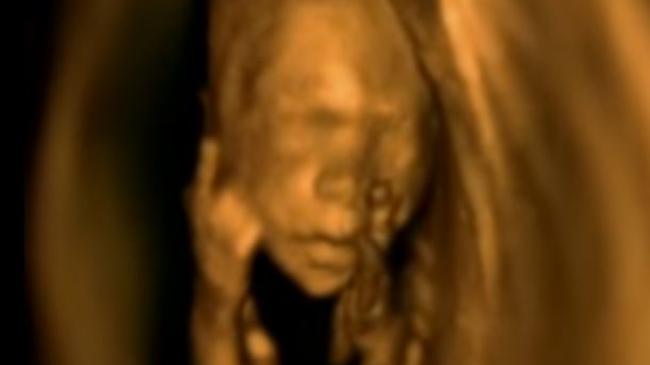 Ce face bebe-ul sub inimioara mamei sale. Video emoționant!