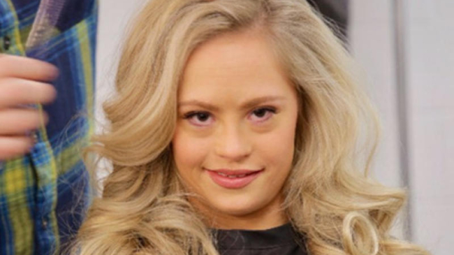 Впервые в конкурсе красоты победила «солнечная» девушка (ФОТО)