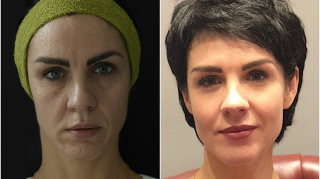 Clinica Limerance oferă o transformare miraculoasă de Revelion, cu o reducere impresionantă!