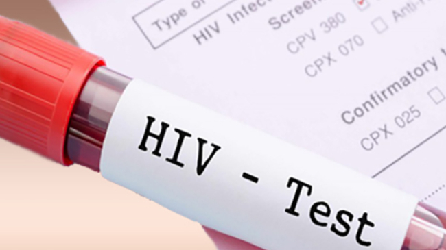 Pe 1 decembrie, doritorii pot face gratuit testul rapid la HIV pe salivă