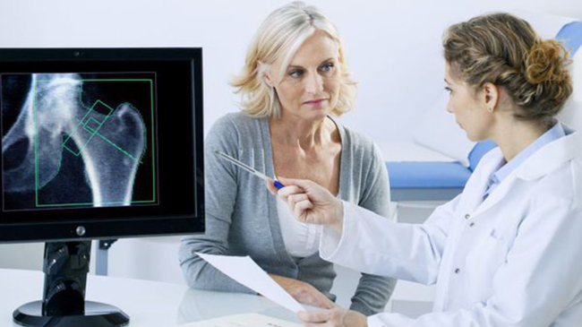 Care este legătura între menopauză și osteoporoză