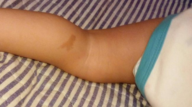 O moldoveancă a născut în Italia un copil cu harta Moldovei pe picior