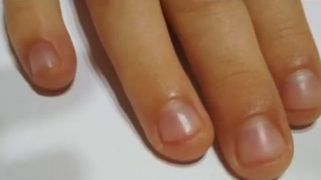 Scandal la grădinița 210 din Capitală. Educatoarea le-ar fi tăiat unghiile copiilor din carne