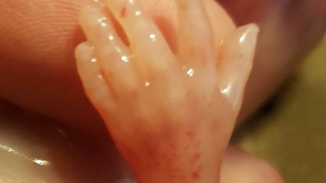 Bebeluș pierdut la 14 săptămâni. Mama îndurerată: „Nu e doar o aglomerare de celule!”