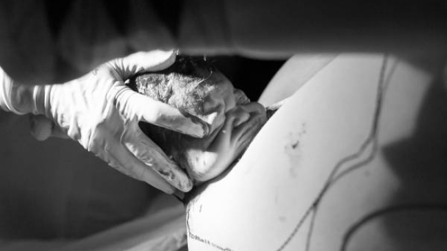 Colecția de fotografii fascinante care surprind momentul când capul bebelușului apare pe lume!