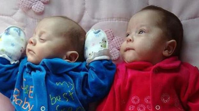 Женщина после клинической смерти родила здоровых близнецов