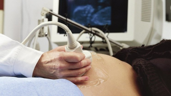 29-летняя девственница забеременела с помощью ЭКО, чтобы не спать с мужчинами