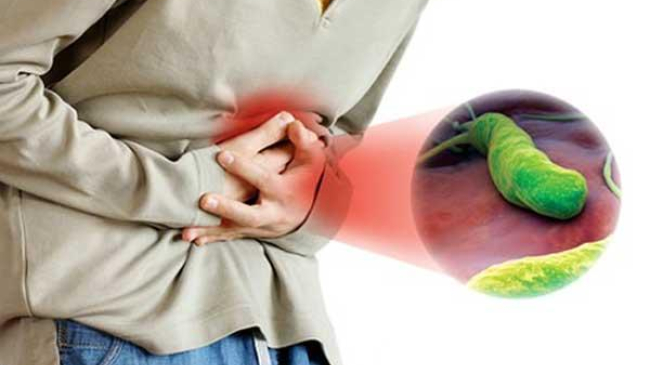 Cea mai bună modalitate de a diagnostica Helicobacter pylori