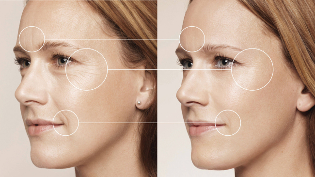 Crema care te scapă de riduri într-o oră