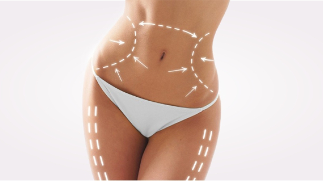 Fără durere și cicatrici! Intervenția care te scapă de grăsimi și piele întinsă în doar 2 luni (VIDEO)