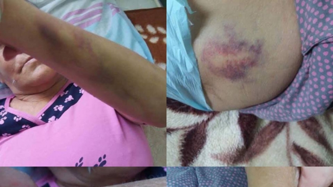 Bolnavi înfometați și agresați fizic, la un spital de psihiatrie