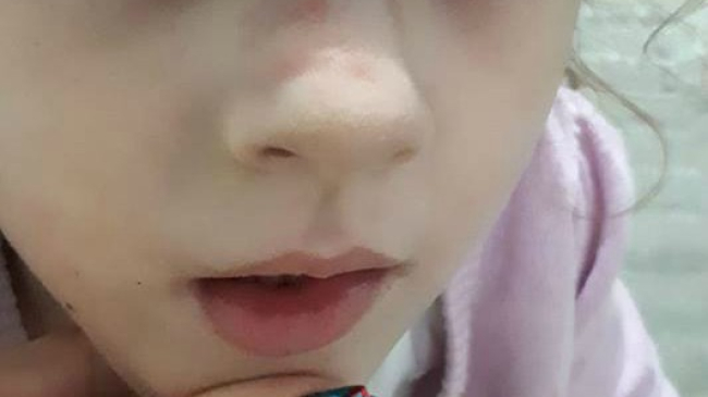 O mamă se plânge că fiica ei a fost agresată la grădiniță