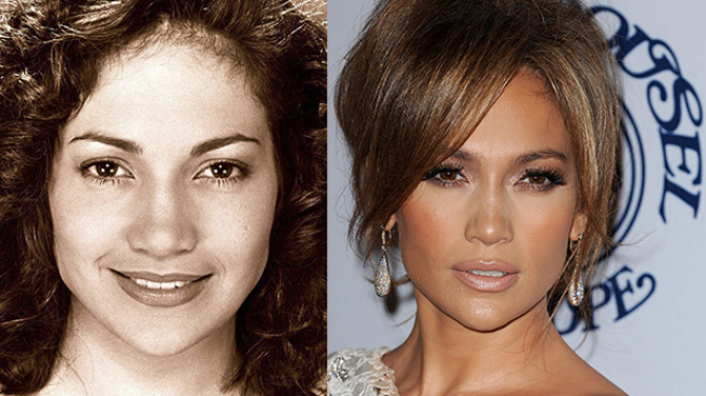 Какие пластические операции делали Дженнифер Лопес и Леди Гага