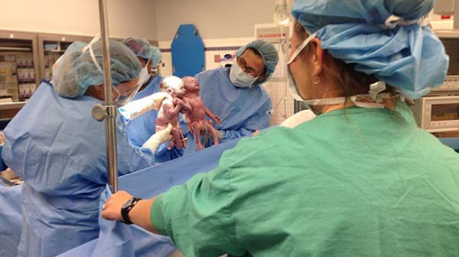 Родившиеся двойняшки привели в умиление весь медицинский персонал