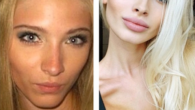 Пластические операции и фотошоп: блогеры рассекретили звезд интернета