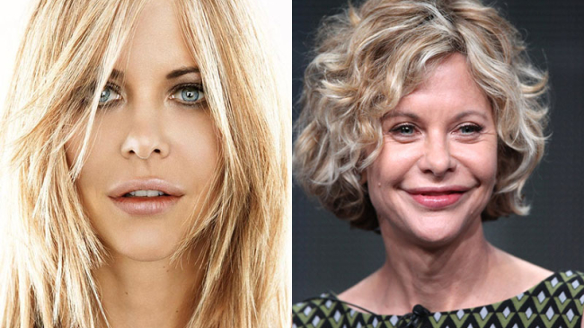 5 звезд, чья карьера закончилась после пластической операции