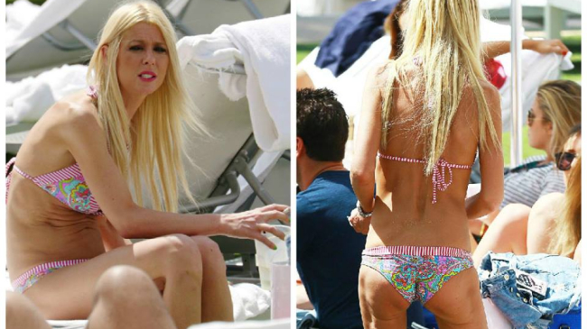 Больно смотреть: истощенная Тара Рид в купальнике