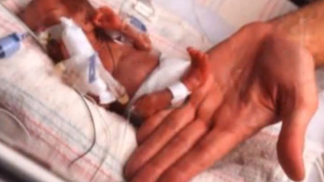 Ни один врач не стал бы спасать этого ребенка, если бы его мама не солгала о сроке беременности...