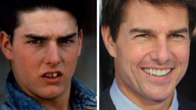 Улыбка на миллион: 20 примеров того, как зубы поменяли внешность знаменитых людей