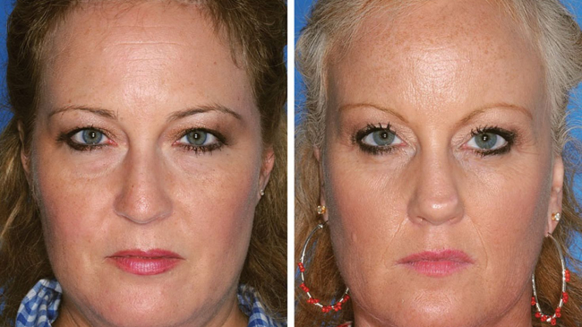 Fumatul provoacă îmbătrânirea prematură (foto)