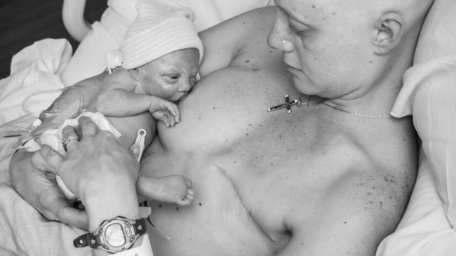 Мать с раком груди кормит своего новорожденного малыша