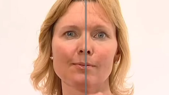 Эффективные упражнения для подтяжки лица. Ошеломляющий результат и никаких операций!