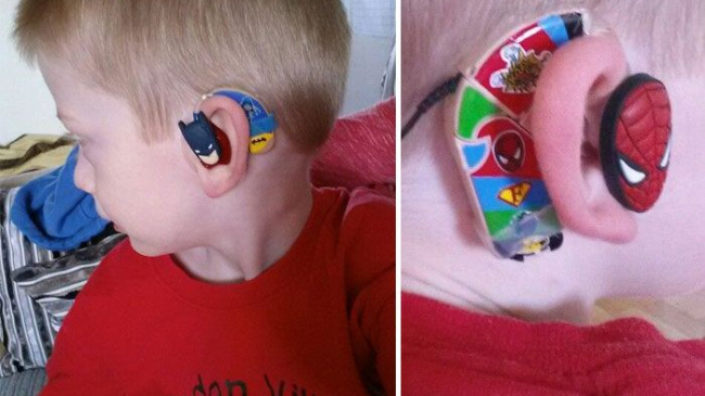 Ее сын стеснялся носить слуховой аппарат. Но это вдохновило ее на отличную идею!