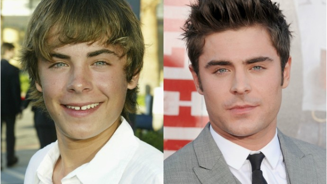 Знаменитые актеры, не раз прибегавшие к пластической хирургии ради Голливуда