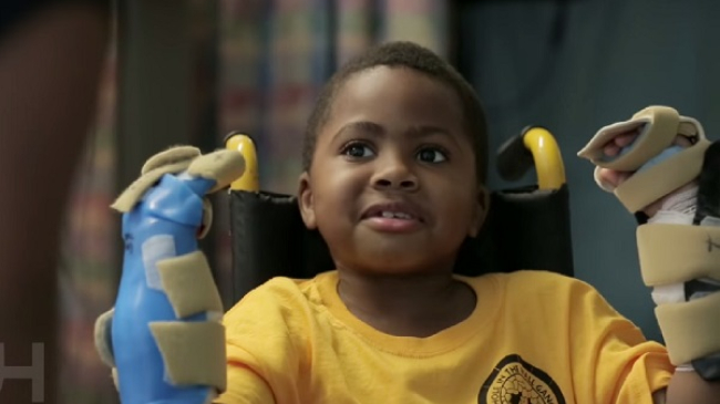 Врачи в США пересадили кисти рук восьмилетнему мальчику